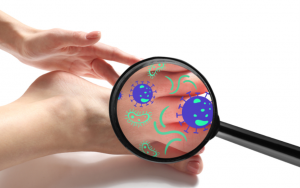 Những nguyên nhân gây nên tình trạng hôi chân